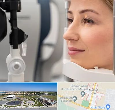 دکتر فوق تخصص چشم در ملارد