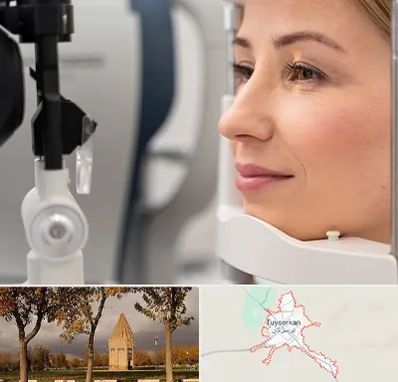 دکتر فوق تخصص چشم در تویسرکان