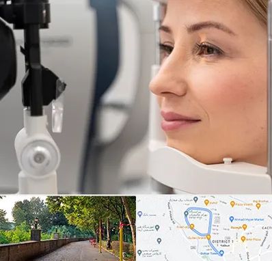 دکتر فوق تخصص چشم در فلکه گاز رشت 