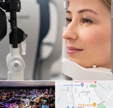 دکتر فوق تخصص چشم در گلسار رشت 