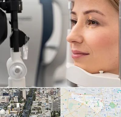 دکتر فوق تخصص چشم در منطقه 18 تهران 