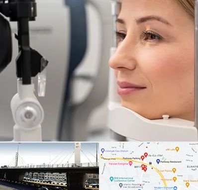 دکتر فوق تخصص چشم در پارک وی 