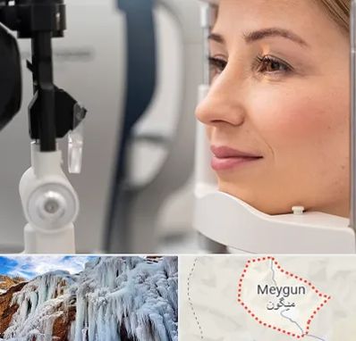 دکتر فوق تخصص چشم در میگون