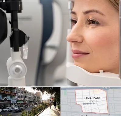 دکتر فوق تخصص چشم در خیابان جمالزاده