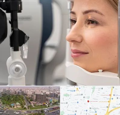 دکتر فوق تخصص چشم در آیت الله کاشانی