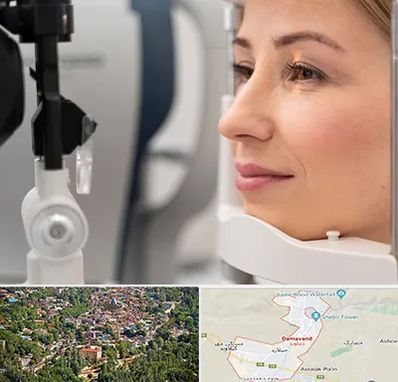 دکتر فوق تخصص چشم در دماوند