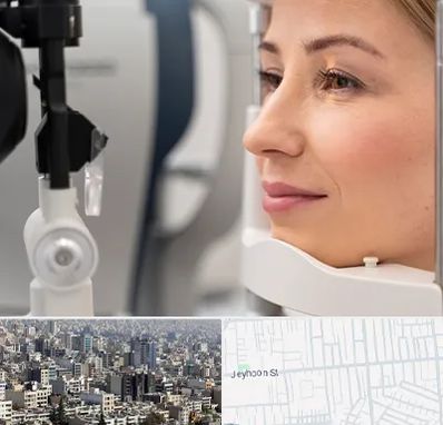 دکتر فوق تخصص چشم در جیحون