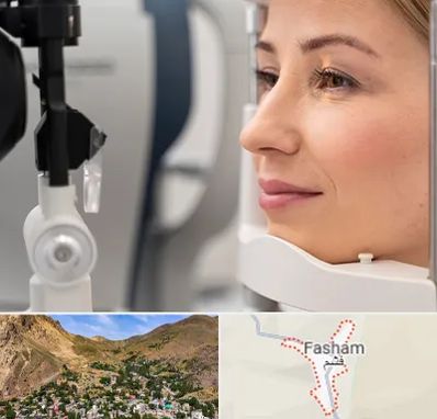 دکتر فوق تخصص چشم در فشم