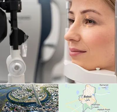 دکتر فوق تخصص چشم در بابل
