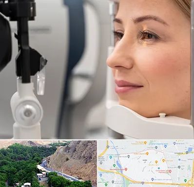 دکتر فوق تخصص چشم در کن 