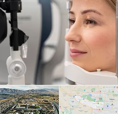 دکتر فوق تخصص چشم در منطقه 21 تهران 