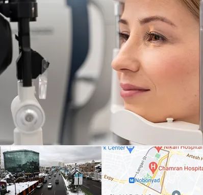 دکتر فوق تخصص چشم در اقدسیه 