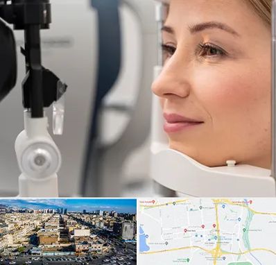 دکتر فوق تخصص چشم در شهرک راه آهن 