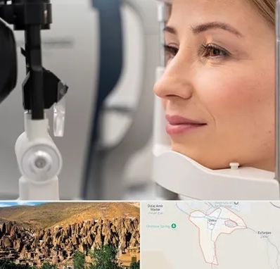 دکتر فوق تخصص چشم در اسکو