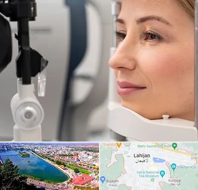 دکتر فوق تخصص چشم در لاهیجان