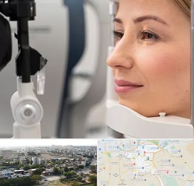 دکتر فوق تخصص چشم در منطقه 20 تهران 