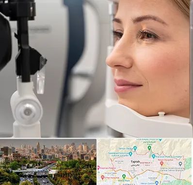 دکتر فوق تخصص چشم در منطقه 1 تهران 