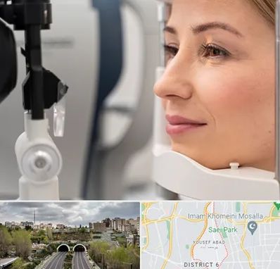 دکتر فوق تخصص چشم در یوسف آباد 