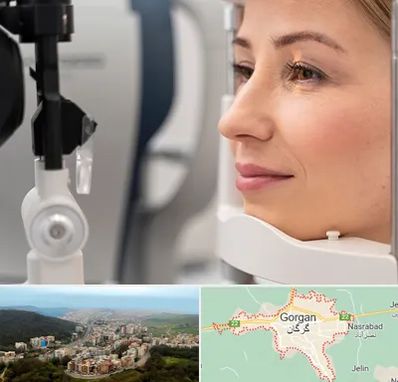 دکتر فوق تخصص چشم در گرگان
