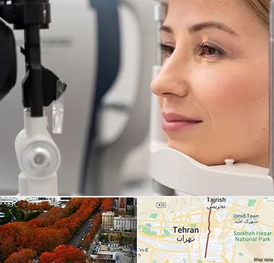 دکتر فوق تخصص چشم در ولیعصر 