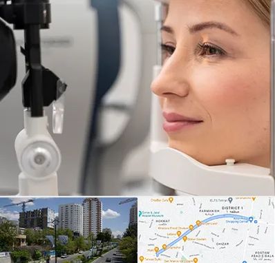 دکتر فوق تخصص چشم در اندرزگو 