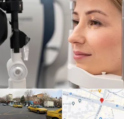 دکتر فوق تخصص چشم در شهناز تبریز