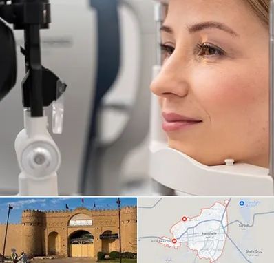 دکتر فوق تخصص چشم در ایرانشهر