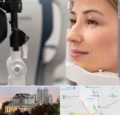 دکتر فوق تخصص چشم در فرشته 