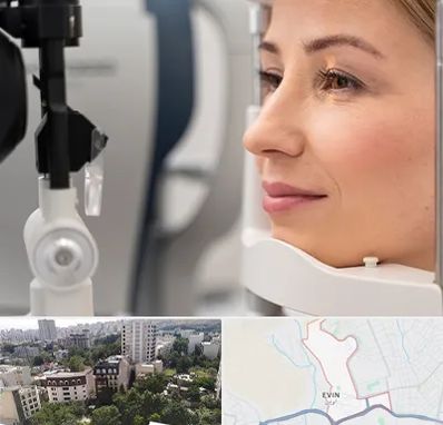 دکتر فوق تخصص چشم در اوین