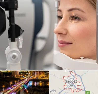 دکتر فوق تخصص چشم در سقز