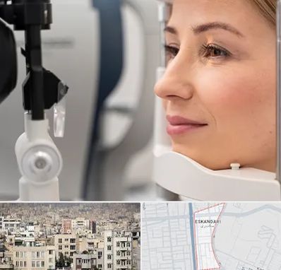 دکتر فوق تخصص چشم در اسکندری