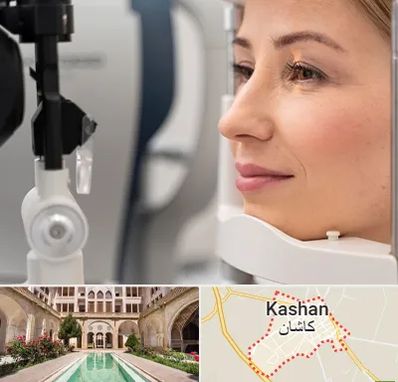 دکتر فوق تخصص چشم در کاشان
