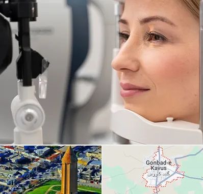 دکتر فوق تخصص چشم در گنبد کاووس