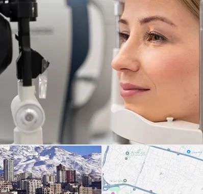 دکتر فوق تخصص چشم در ازگل