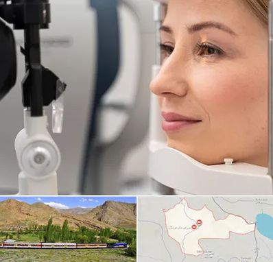 دکتر فوق تخصص چشم در خاش