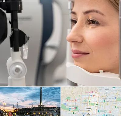دکتر فوق تخصص چشم در منطقه 2 تهران 