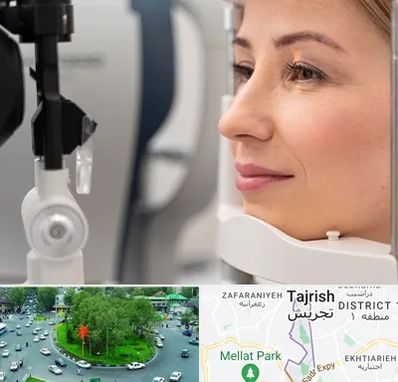 دکتر فوق تخصص چشم در تجریش 