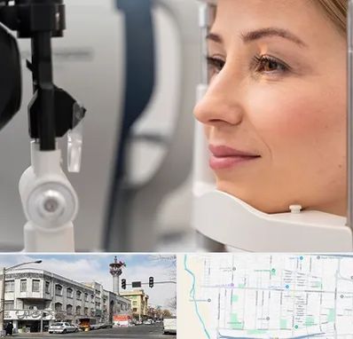 دکتر فوق تخصص چشم در 17شهریور