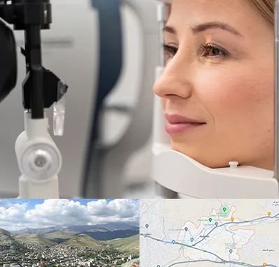 دکتر فوق تخصص چشم در رودهن