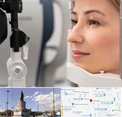 دکتر فوق تخصص چشم در کارگر جنوبی 