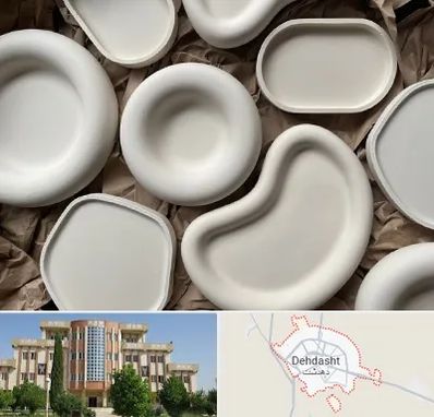 فروش ظروف سفالی در دهدشت