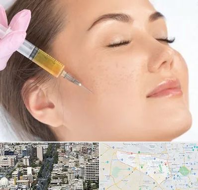 آموزش تزریق ژل و بوتاکس در منطقه 18 تهران 