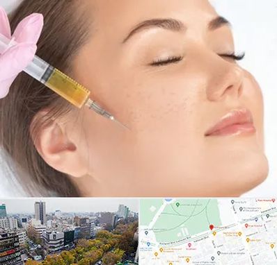 آموزش تزریق ژل و بوتاکس در بلوار کشاورز 