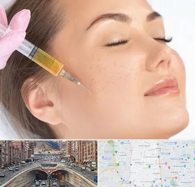 آموزش تزریق ژل و بوتاکس در منطقه 10 تهران 