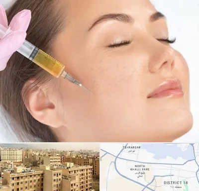 آموزش تزریق ژل و بوتاکس در جنوب غرب تهران