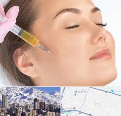 آموزش تزریق ژل و بوتاکس در ازگل