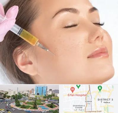 آموزش تزریق ژل و بوتاکس در ونک 