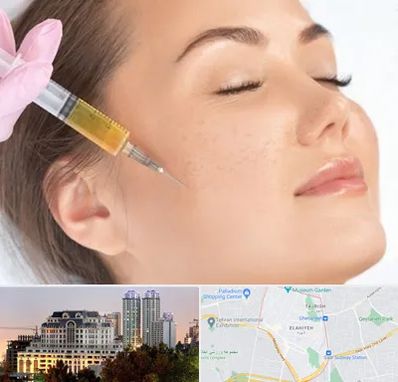 آموزش تزریق ژل و بوتاکس در فرشته 