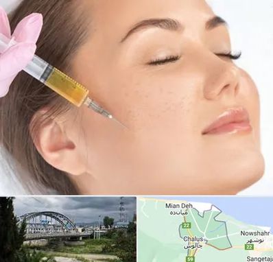 آموزش تزریق ژل و بوتاکس در چالوس