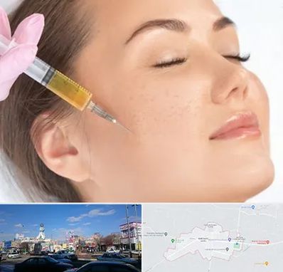 آموزش تزریق ژل و بوتاکس در ماهدشت کرج 